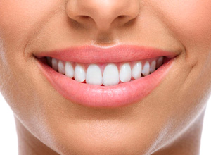 Mujer con dientes blancos